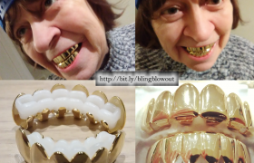 BlingBlowout.com - Gold Grillz Shiny Top & Bottom Teeth Combo